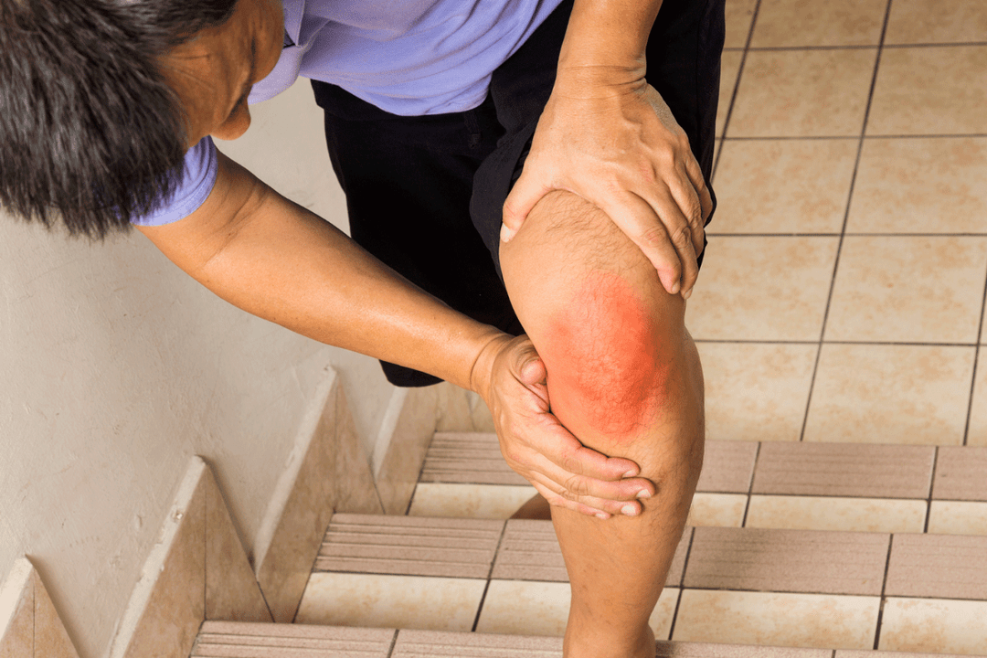 bolesť kĺbov v dôsledku artrózy