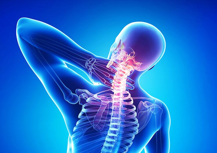 Osteochondróza chrbtice je ochorenie, ktoré postihuje kĺbovú chrupavku a stavce.
