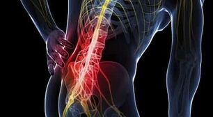 príčiny bolesti chrbta